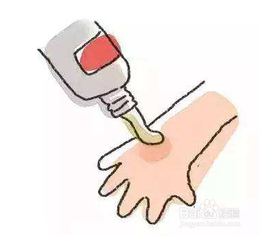 换季易过敏怎么办？