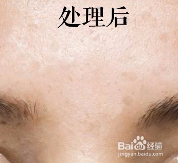 如何使用PS完成对照片中人物脸部的祛痣祛痘