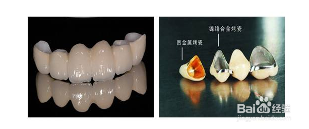 预防牙龈出血需要注意哪些方面