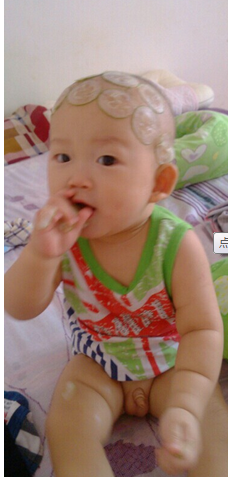 夏天怎么预防宝宝长痱子？