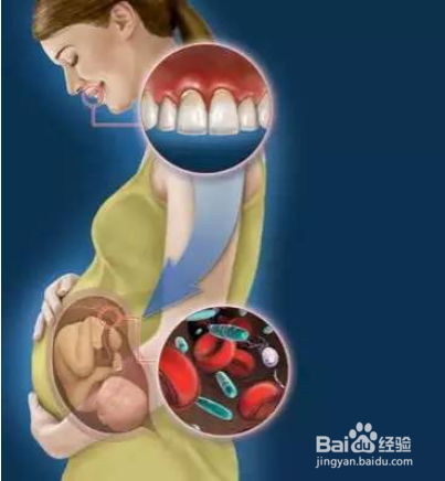 孕前牙齿检查需要注意的事项
