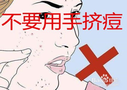 长大痘痘怎么办