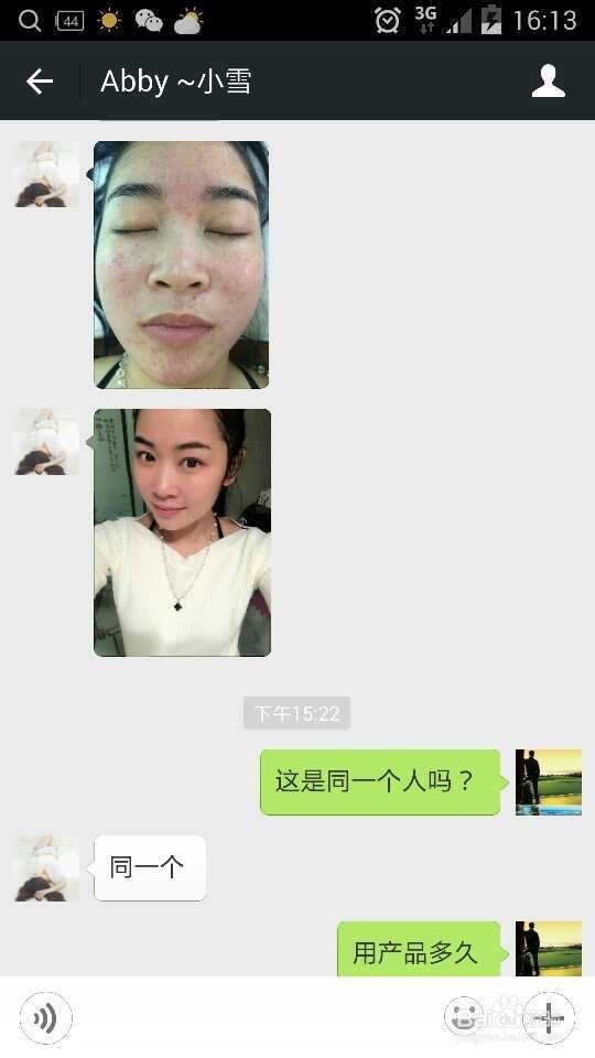 怎样快速修复过敏