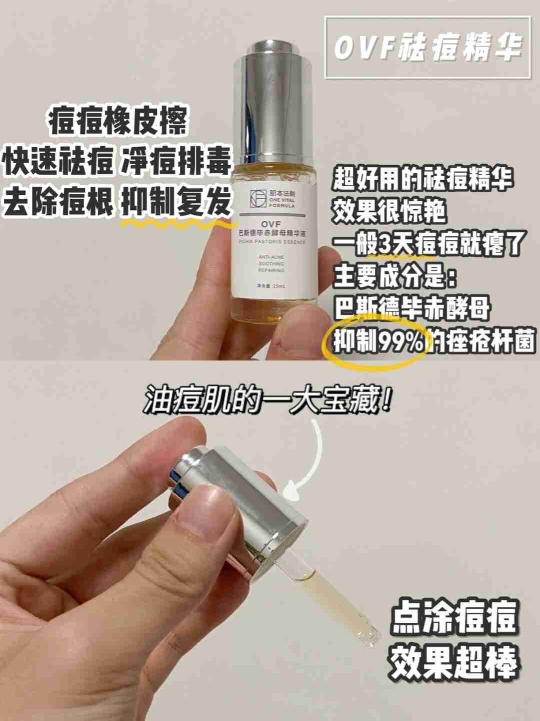 三年烂脸经验 祛痘精华宝藏推荐‼️