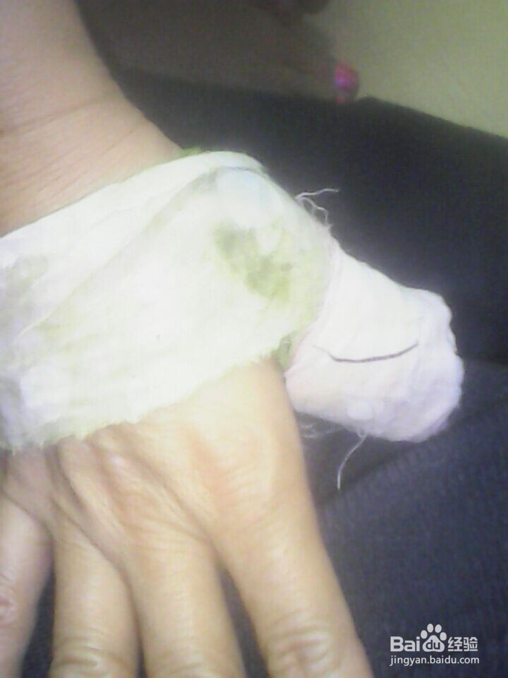 肿痛 怎么办 才能好的快