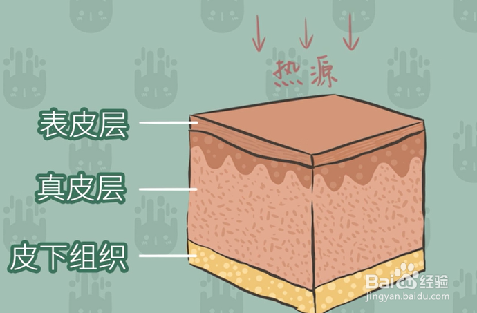 烫伤后的正确处理方法有哪些？