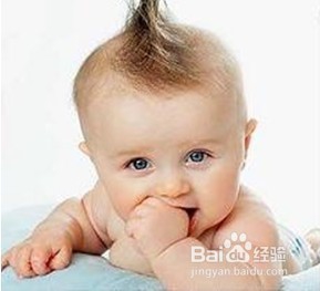 <b>几个月的宝宝总是用手挠后脑勺怎么办</b>
