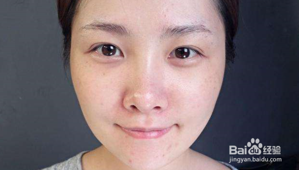 怎么做才可以清除黑头?