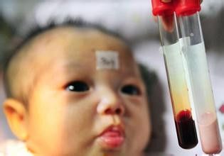 血脂高应注意什么?