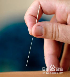 怎样对待小儿的遗尿症？
