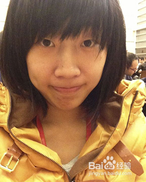 全切双眼皮效果很不错