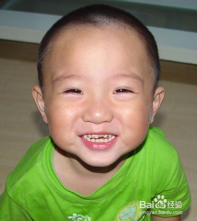 宝宝出牙晚这一次只长出一颗乳牙龋齿