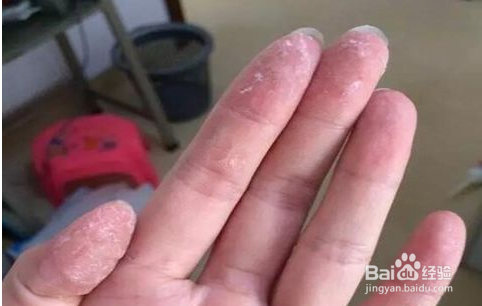 手上粘有强力胶、玻璃胶,怎么办?