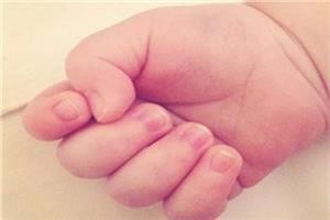 手指甲有点泛白是什么原因