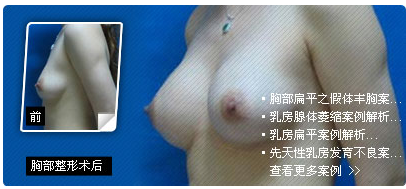 韩式假体隆胸手术效果好不好
