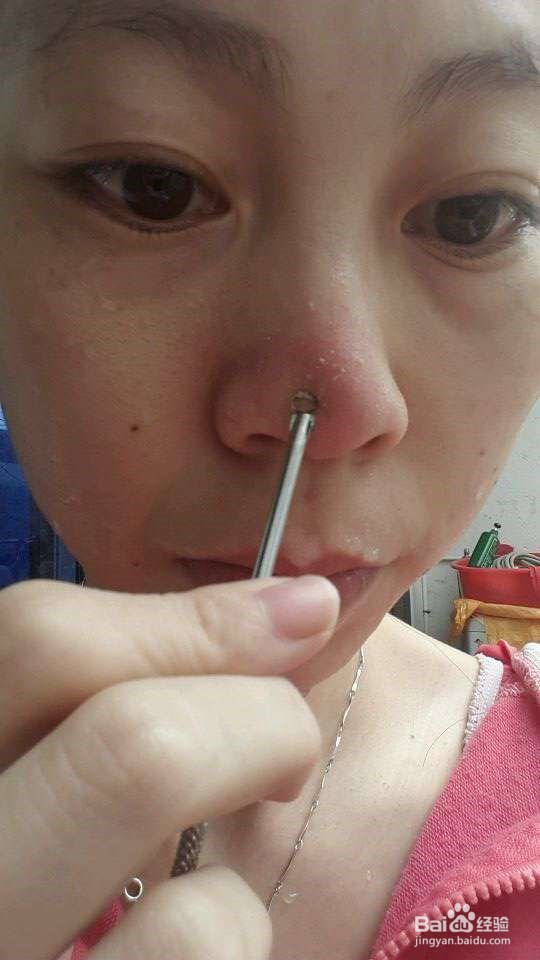 清洁皮肤预防粉刺痘痘再生