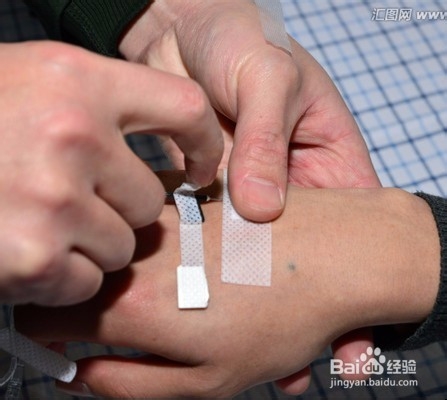 感冒后注意事项—抵御感冒