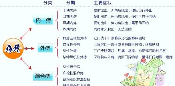 做痔疮手术的注意事项