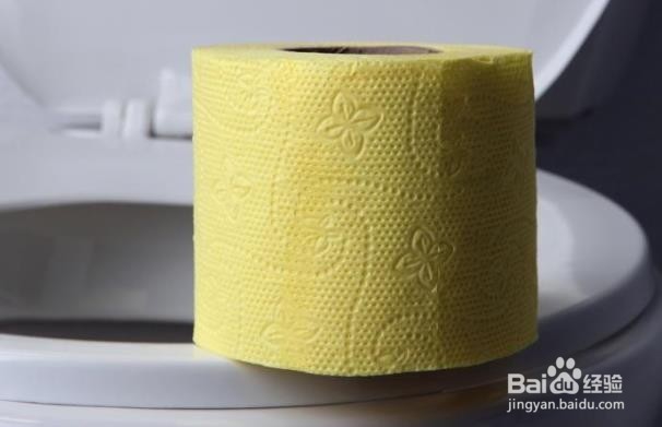 结肠癌的十大体征