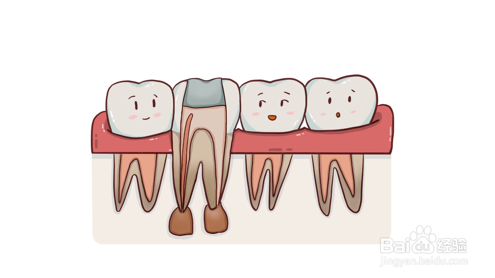 什么是根管治疗？有什么危害？