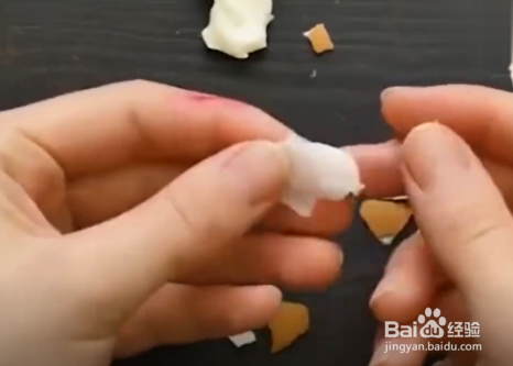 怎么快速处理小伤口