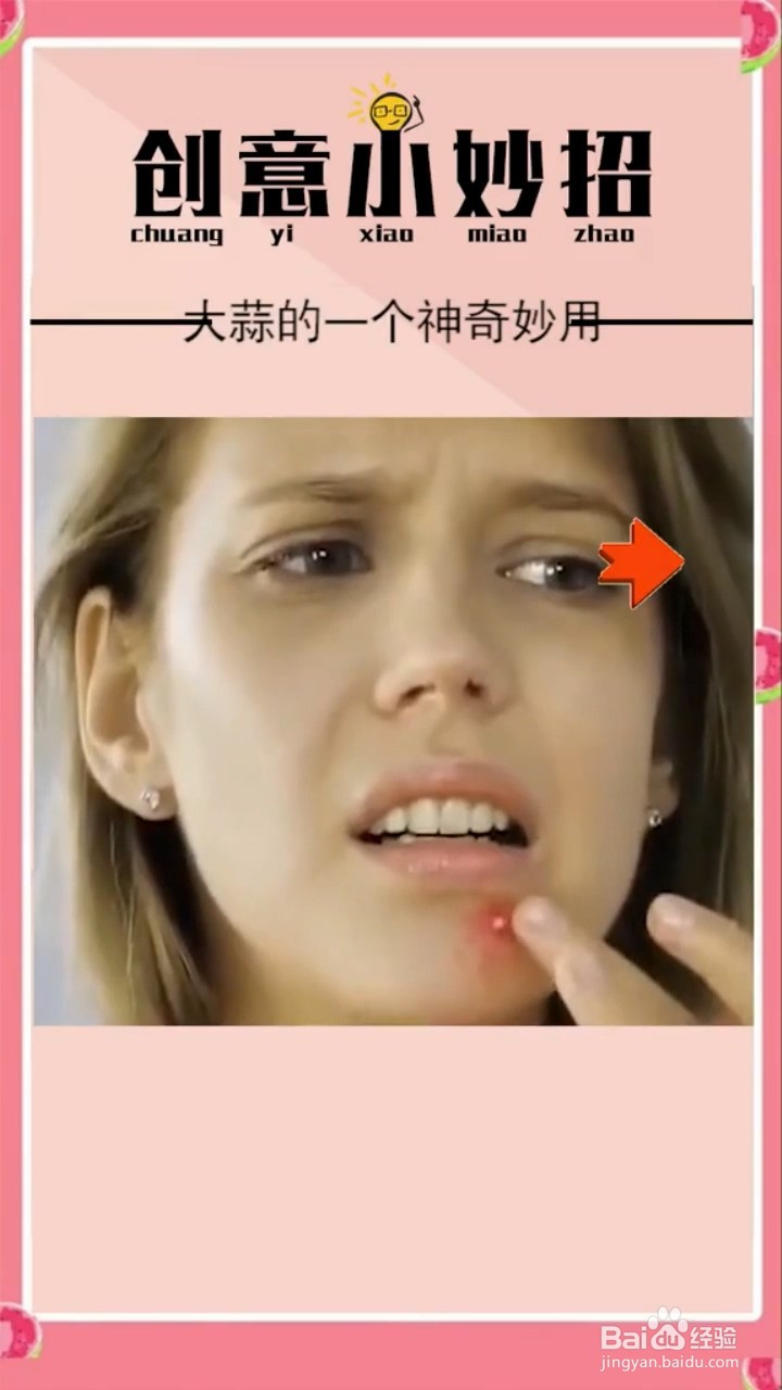 大蒜的神奇妙用是什么