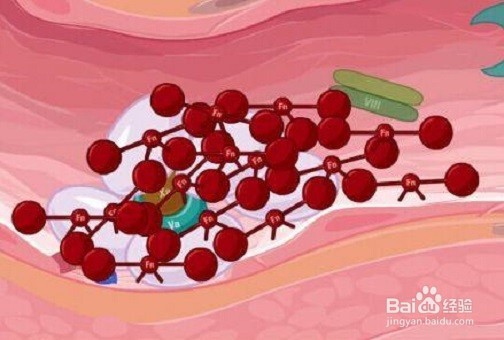 血友病有什么病症，会遗传吗？