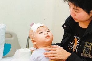 常见内科病之传染病治疗方法：[2]流行脑膜炎