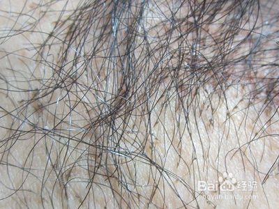 恐怖的意外得病——读后总结预防经验