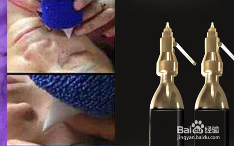 医学祛斑有哪些方法？医学祛斑价格多少？