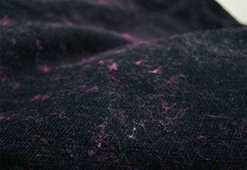 粘毛怎么办呢？