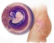 准妈妈应注意防止哪些环境伤害