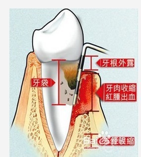 日常如何保护牙牙齿