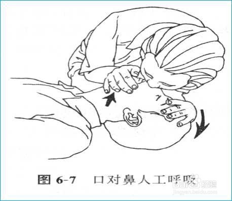 急救知识--心肺复苏