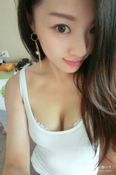 子宫肌瘤的临床表现有哪些症状