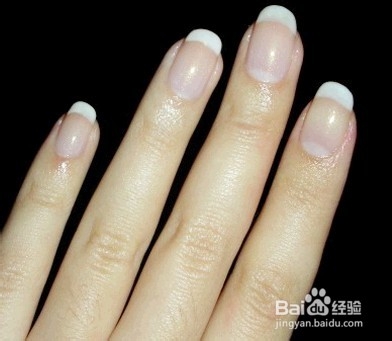 指甲暗淡干燥是为什么？指甲暗淡该怎么办？