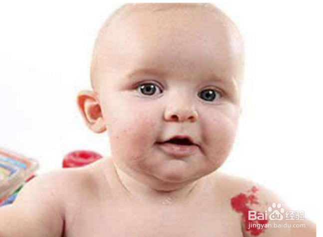 如何对新生宝宝的皮肤问题？