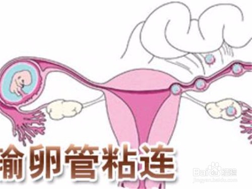 造影和通液哪个伤害小 造影和通液的区别