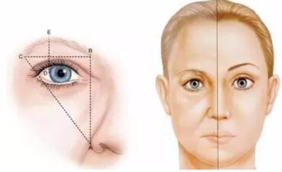女性眼睛下垂做提眉手术性价比最高