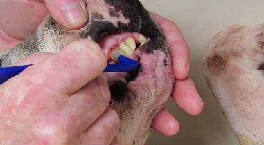 狗牙结石怎么去除