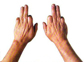 弹筝者怎样锻炼手指的灵活度