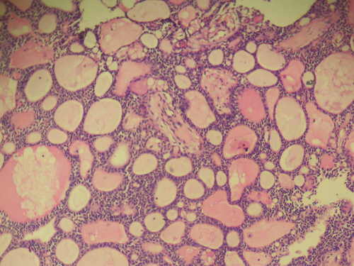 鼻塞的原因和治疗
