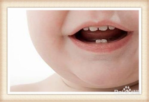 怎样才是护理好宝宝牙齿的正确攻略