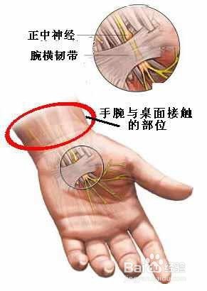 怎么防止手机玩久的手残