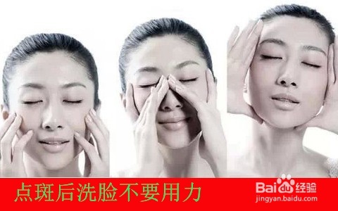 用药水点斑后怎么护理/点斑水点斑后如何保养