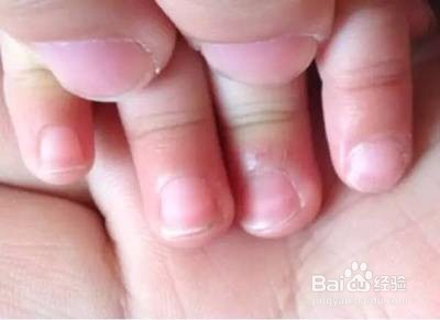 妈妈们千万不要这样给宝宝剪指甲!