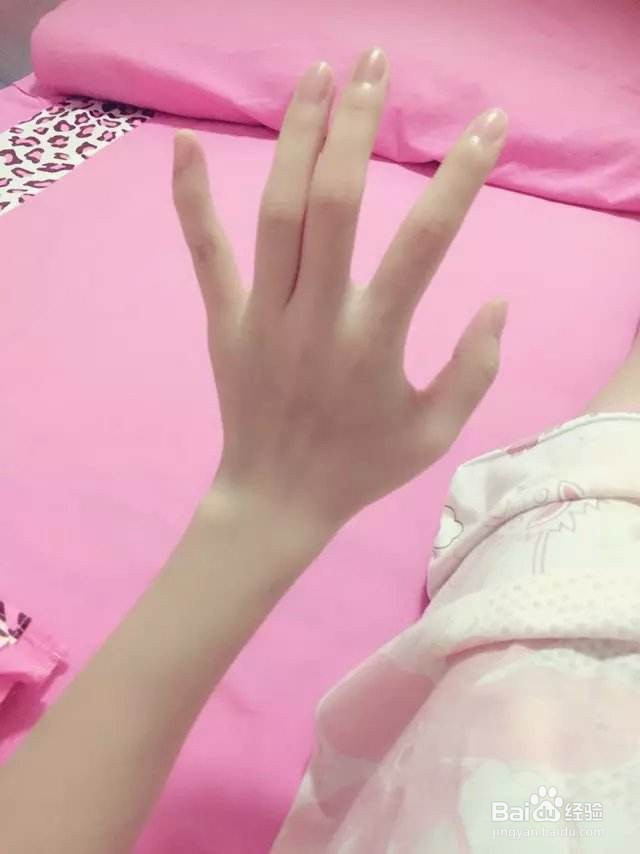 胳膊麻手麻是怎么回事颈椎会痛、胳膊会麻