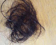 怎样根据头部判断身体所需补充的营养