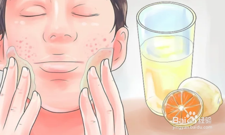 快速去痘疤的方法