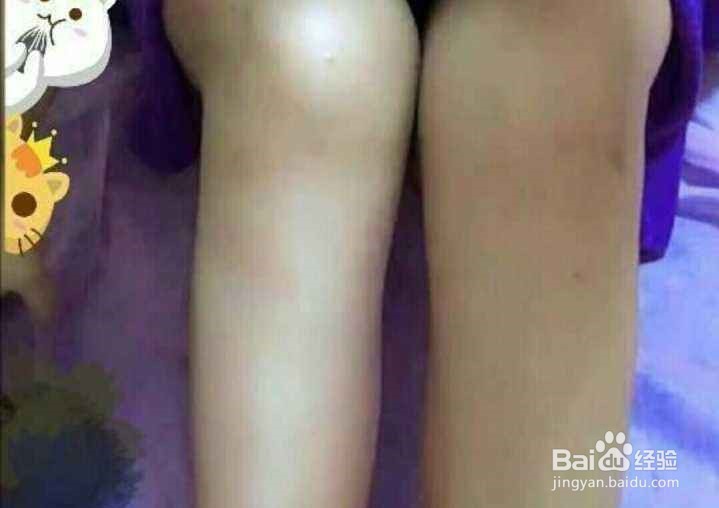 怎样快速瘦腿？